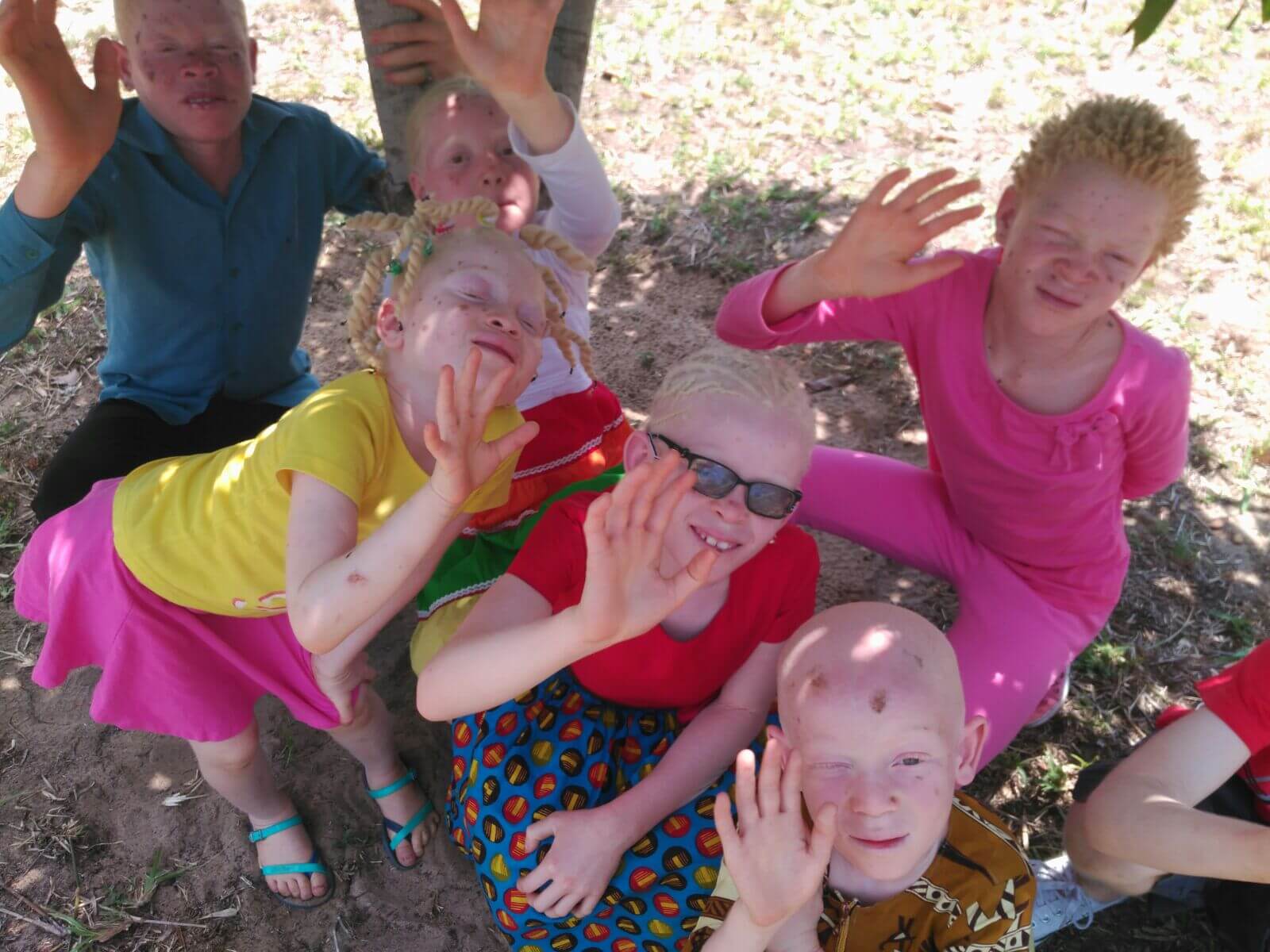 Niños con albinismo en Mozambique